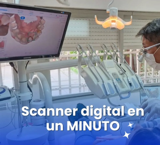 Tecnología digital 3D para planificación de implantes dentales